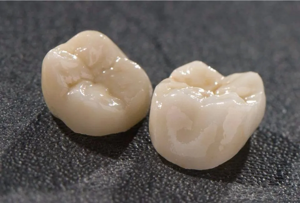 Dental crown restorations for Tupelo, Mississippi dental practices